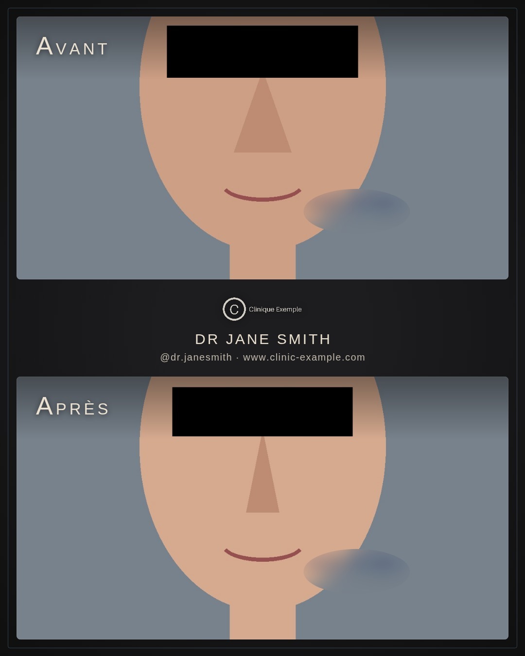 Exemple anonymisé (images de démonstration)